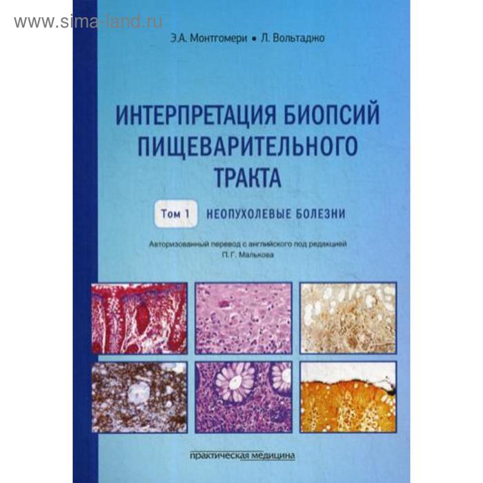 Интерпретация биопсий пищеварительного тракта. Т. 1: Неопухолевые болезни. Монтгомери Э.А., Вольтаджо Л.
Интерпретация биопсий пищеварительного тракта. Т. 1: Неопухолевые болезни. Монтгомери Э.А., Вольтаджо Л.