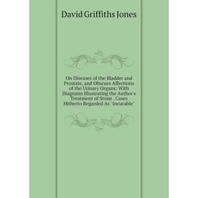 Книга On Diseases of the Bladder and Prostate, and Obscure Affections of the Urinary Organs: With Diagrams Illustrating the Author's Treatment of Ston
Книга On Diseases of the Bladder and Prostate, and Obscure Affections of the Urinary Organs: With Diagrams Illustrating the Author's Treatment of Ston