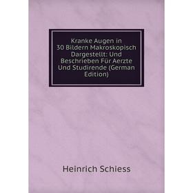 Книга Kranke Augen in 30 Bildern Makroskopisch Dargestellt: Und Beschrieben Für Aerz te Und Studirende
Книга Kranke Augen in 30 Bildern Makroskopisch Dargestellt: Und Beschrieben Für Aerz te Und Studirende