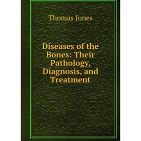 Книга Diseases of the Bones: Their Pathology, Diagnosis, and Treatment. Thomas Jones
Книга Diseases of the Bones: Their Pathology, Diagnosis, and Treatment. Thomas Jones