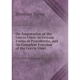 Книга On Amputation of the Cervix Uteri: In Certain Forms of Procidentia, and On Complete Eversion of the Cervix Uteri
Книга On Amputation of the Cervix Uteri: In Certain Forms of Procidentia, and On Complete Eversion of the Cervix Uteri