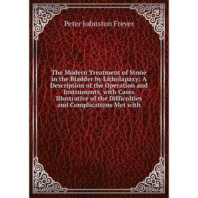 Книга The Modern Treatment of Stone in the Bladder by Litholapaxy: A Description of the Operation and Instruments, with Cases Illustrative of the Diff
Книга The Modern Treatment of Stone in the Bladder by Litholapaxy: A Description of the Operation and Instruments, with Cases Illustrative of the Diff