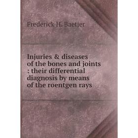 Книга Injuries & diseases of the bones and joints : their differential diagnosis by means of the roentgen rays
Книга Injuries & diseases of the bones and joints : their differential diagnosis by means of the roentgen rays