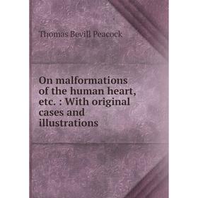 Книга On malformations of the human heart, etc.: With original cases and illustrations
Книга On malformations of the human heart, etc.: With original cases and illustrations