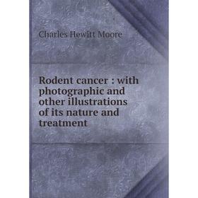 Книга Rodent cancer: with photographic and other illustrations of its nature and treatment
Книга Rodent cancer: with photographic and other illustrations of its nature and treatment
