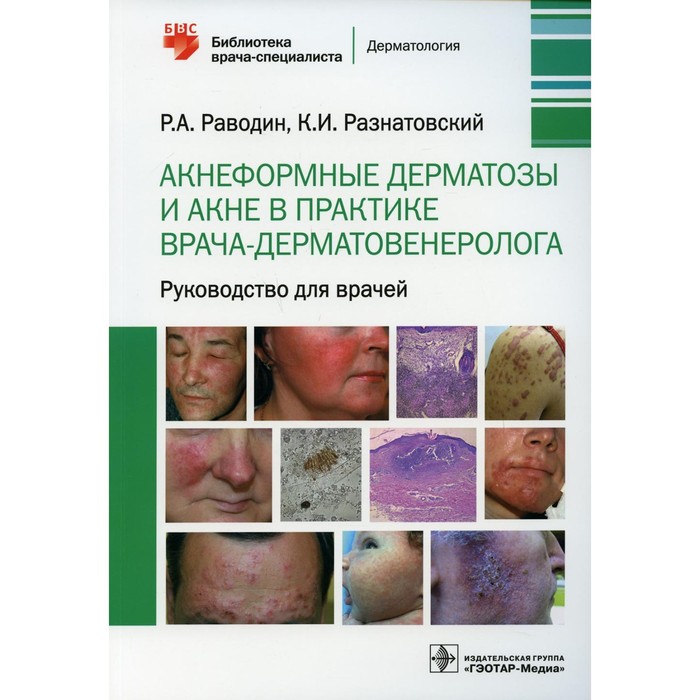 Акнеформные дерматозы и акне в практике врача-дерматовенеролога. Раводин Роман Анатольевич, Разнатовский Константин Игоревич
Акнеформные дерматозы и акне в практике врача-дерматовенеролога. Раводин Роман Анатольевич, Разнатовский Константин Игоревич