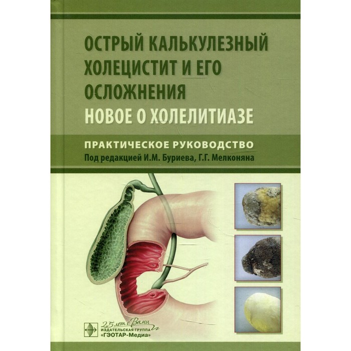 Острый калькулезный холецистит и его осложнения. Новое о холелитиазе. Практическое руководство
Острый калькулезный холецистит и его осложнения. Новое о холелитиазе. Практическое руководство