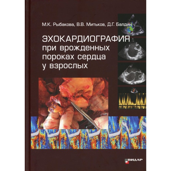 Эхокардиография при врожденных пороках сердца у взрослых. Рыбакова М. К., Митьков В.
Эхокардиография при врожденных пороках сердца у взрослых. Рыбакова М. К., Митьков В.