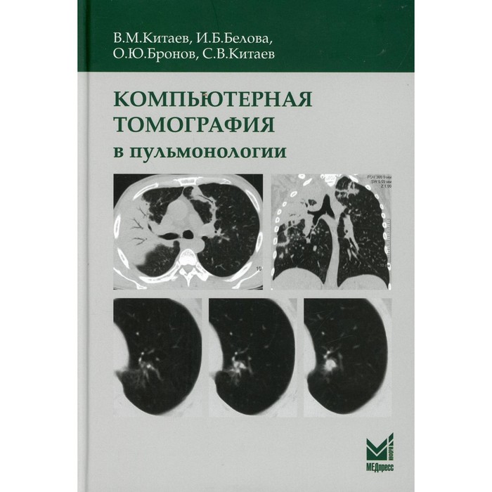 Компьютерная томография в пульмонологии. 3-е издание, дополненное. Китаев В.М., Китаев С.В., Белова И. Б.
Компьютерная томография в пульмонологии. 3-е издание, дополненное. Китаев В.М., Китаев С.В., Белова И. Б.