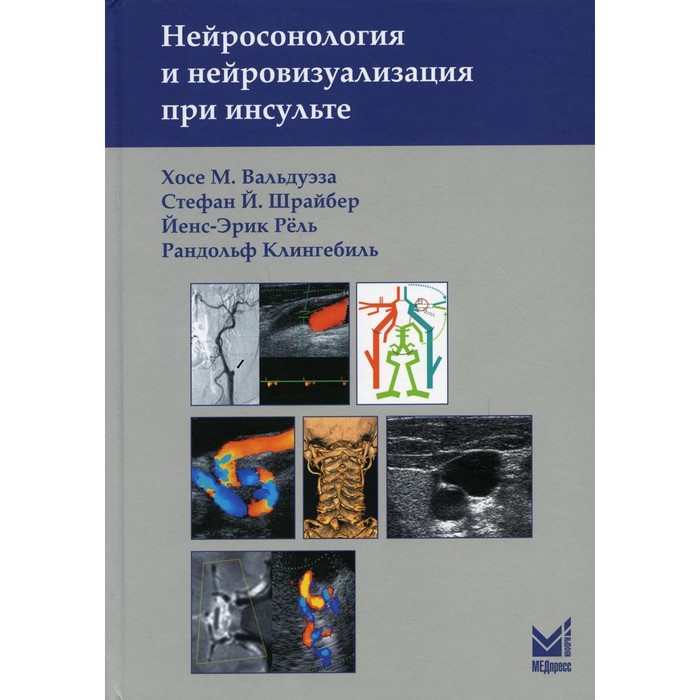 Нейросонология и нейровизуализация при инсульте. 2-е издание. Вальдуэза Х.М., Шрайбер С.Й., Рель Й.-Э., Клингебиль Р.
Нейросонология и нейровизуализация при инсульте. 2-е издание. Вальдуэза Х.М., Шрайбер С.Й., Рель Й.-Э., Клингебиль Р.