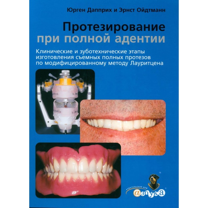 Протезирование при полной адентии. Клинические и зуботехнические этапы изготовления съемных полных протезов по модифицированному методу Лауритцена. Дапприх Ю., Ойдтманн Э.
Протезирование при полной адентии. Клинические и зуботехнические этапы изготовления съемных полных протезов по модифицированному методу Лауритцена. Дапприх Ю., Ойдтманн Э.