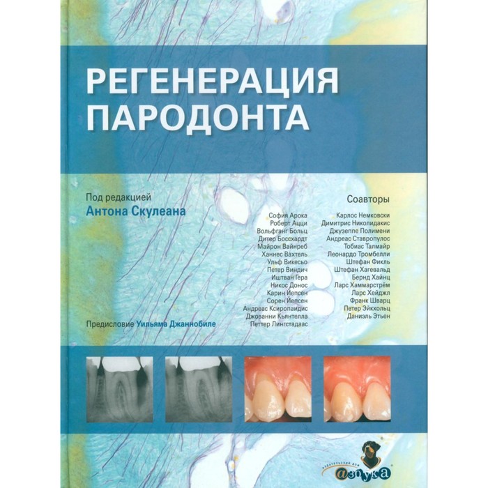 Регенерация пародонта. Черутти А.
Регенерация пародонта. Черутти А.