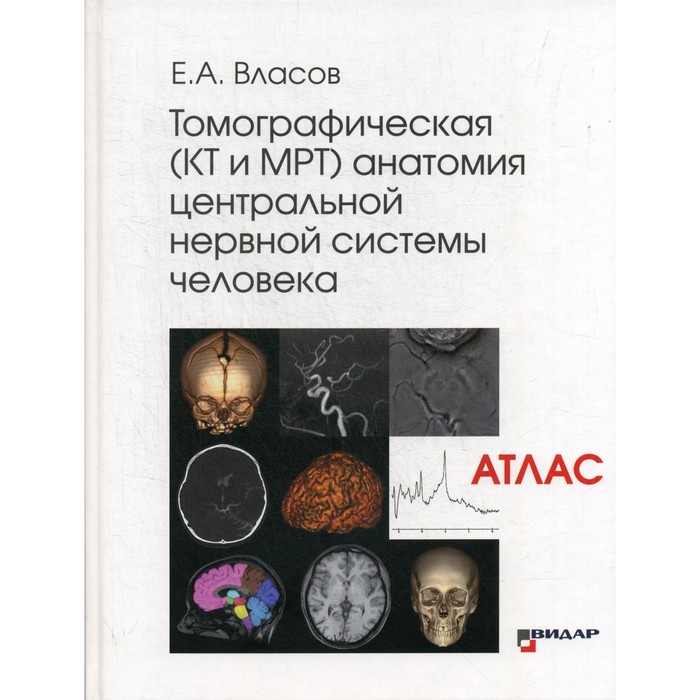 Томографическая (КТ и МРТ) анатомия центральной нервной системы человека. Атлас. Власов Е.А.
Томографическая (КТ и МРТ) анатомия центральной нервной системы человека. Атлас. Власов Е.А.