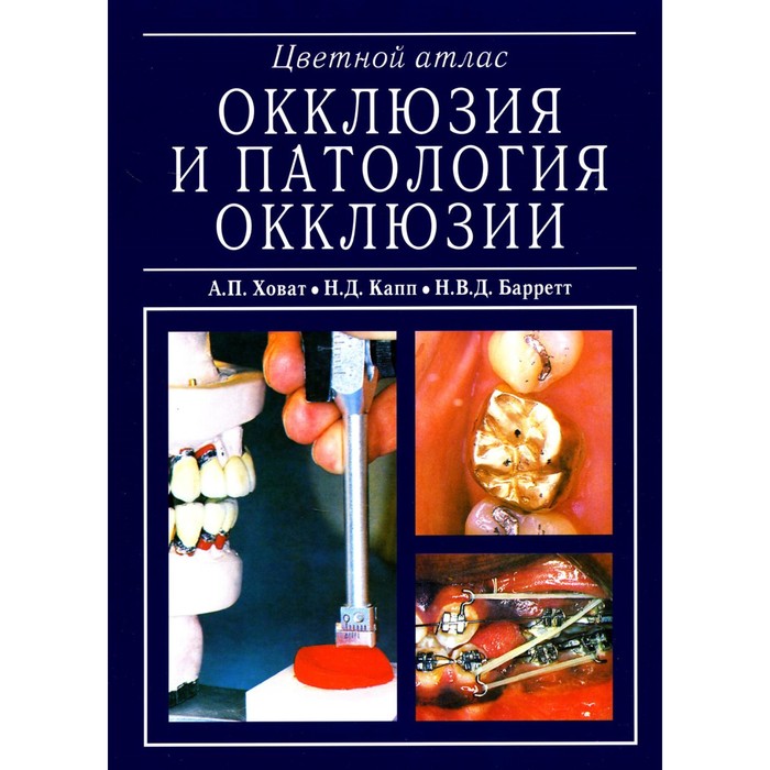 Окклюзия и патология окклюзии. Цветной атлас. Барретт Н.В.Д., Капп Н.Д., Ховат А.П.
Окклюзия и патология окклюзии. Цветной атлас. Барретт Н.В.Д., Капп Н.Д., Ховат А.П.