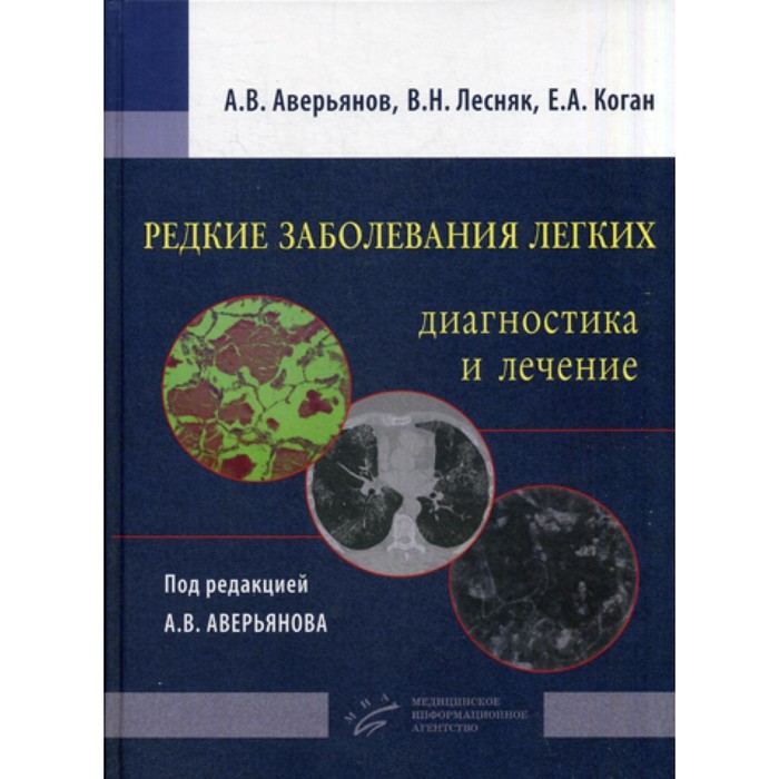 Редкие заболевания легких: диагностика и лечение. Коган Е.А., Аверьянов А.В., Лесняк В.Н.
Редкие заболевания легких: диагностика и лечение. Коган Е.А., Аверьянов А.В., Лесняк В.Н.