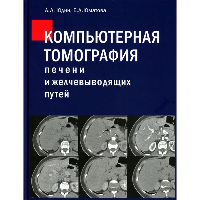 Компьютерная томография печени и желчевыводящих путей. Практическое руководство. Юдин А.Л., Юматова Е.А.
Компьютерная томография печени и желчевыводящих путей. Практическое руководство. Юдин А.Л., Юматова Е.А.