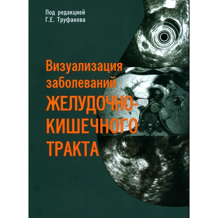 Визуализация заболеваний желудочно-кишечного тракта. Учебное пособие. Под ред. Труфанова Г.Е.
Визуализация заболеваний желудочно-кишечного тракта. Учебное пособие. Под ред. Труфанова Г.Е.