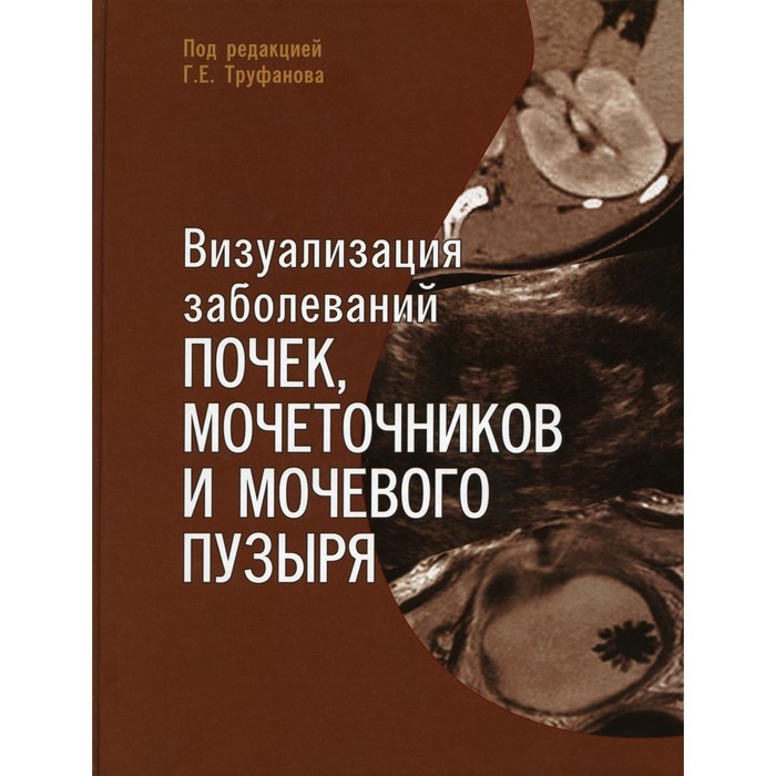 Визуализация заболеваний почек, мочеточников и мочевого пузыря. Учебное пособие. Мищенко А.В., Мащенко И.А., Ефимцев А.Ю.
Визуализация заболеваний почек, мочеточников и мочевого пузыря. Учебное пособие. Мищенко А.В., Мащенко И.А., Ефимцев А.Ю.