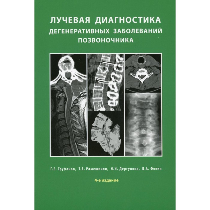 Лучевая диагностика дегенеративных заболеваний позвоночника. 4-е издание. Рамешвили Т.Е., Труфанов Г.Е., Дергунова Н.И.
Лучевая диагностика дегенеративных заболеваний позвоночника. 4-е издание. Рамешвили Т.Е., Труфанов Г.Е., Дергунова Н.И.