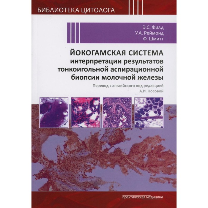 Йокогамская система интерпретации результатов тонкоигольной аспирационной биопсии молочной железы. Филд Э.С., Реймонд У.С., Шмитт Ф.
Йокогамская система интерпретации результатов тонкоигольной аспирационной биопсии молочной железы. Филд Э.С., Реймонд У.С., Шмитт Ф.