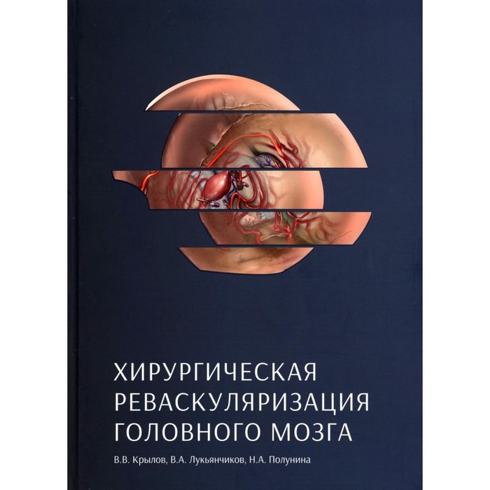 Хирургическая реваскуляризация головного мозга. Крылов В.В., Лукьянчиков В.А., Полунина Н.А. 10651
Хирургическая реваскуляризация головного мозга. Крылов В.В., Лукьянчиков В.А., Полунина Н.А. 10651