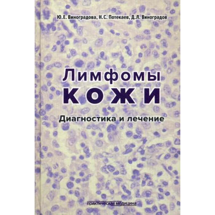 фото Лимфомы кожи: диагностика и лечение. виноградова ю.е. практическая медицина