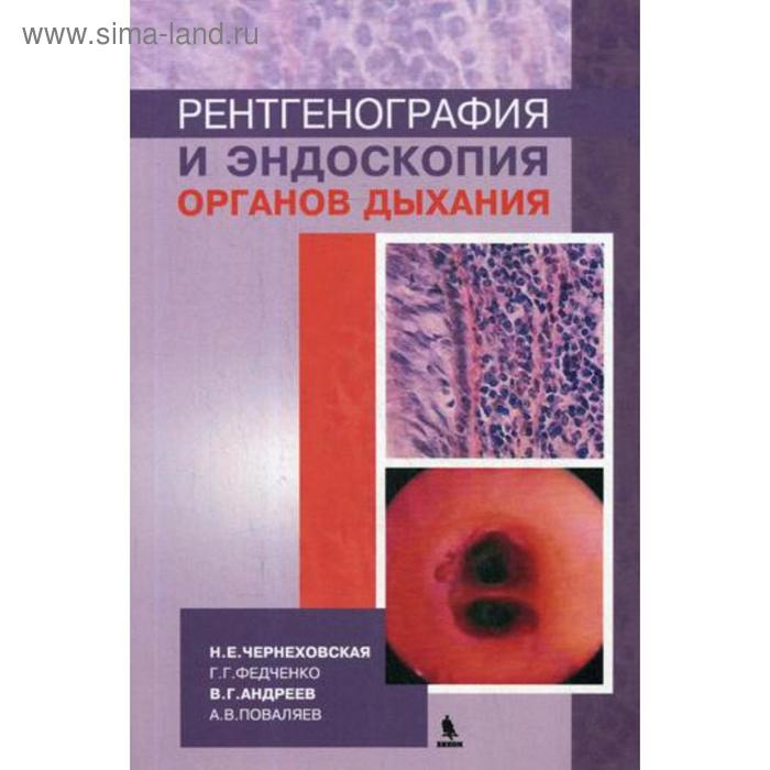 

Рентгенография и эндоскопия органов дыхания: Учебное пособие. Чернеховская Н.Е.
