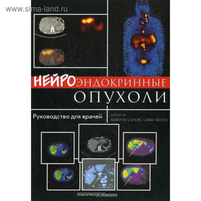 фото Нейроэндокринные опухоли: руководство для врачей. под ред. кэплин м., кволс л. практическая медицина