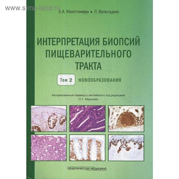 

Интерпретация биопсий пищеварительного тракта. Т. 2: Новообразования. Монтгомери Э.А., Вольтаджо Л.