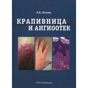 

Крапивница и ангиоотек. Колхир П.В.