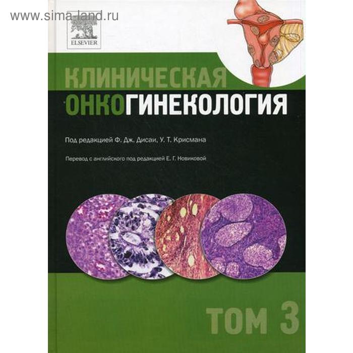 Клиническая онкогинекология. В 3 т. Т. 3. Под ред. Ф.Дж. Дисаи, У.Т. Крисмана