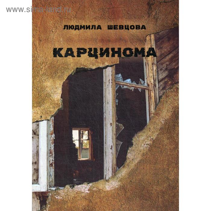 Карцинома. Шевцова Л.И. шевцова л и карцинома