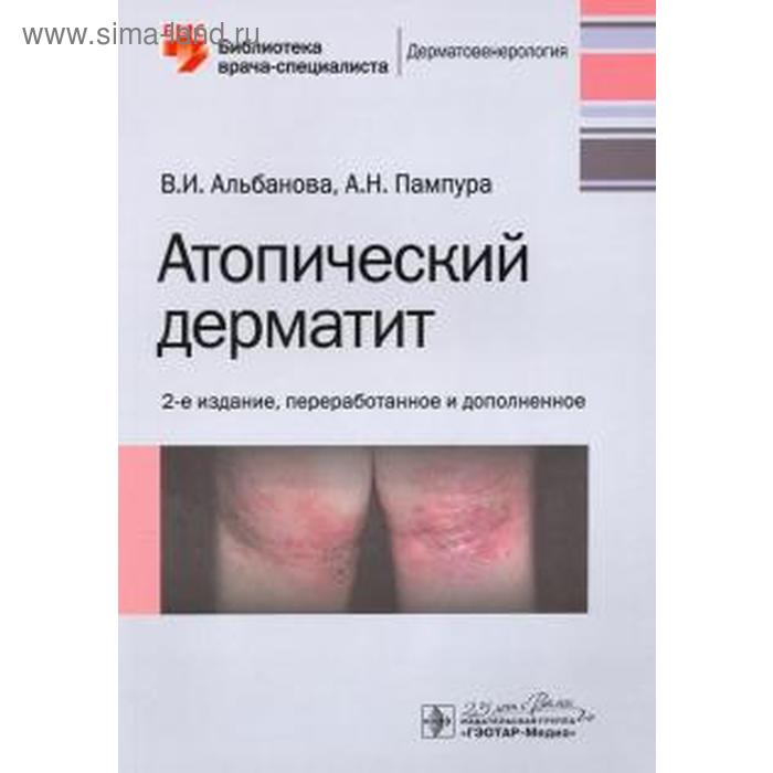 

Атопический дерматит. 2-е издание. Альбанова В., Пампура А.Н.