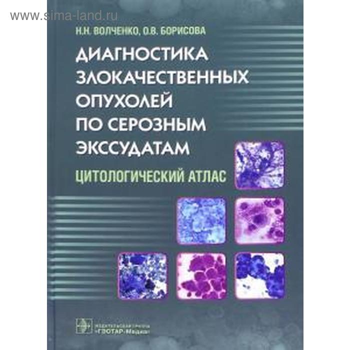 

Волченко, Борисова: Диагностика злокачественных опухолей по серозным экссудатам. Цитологический атлас
