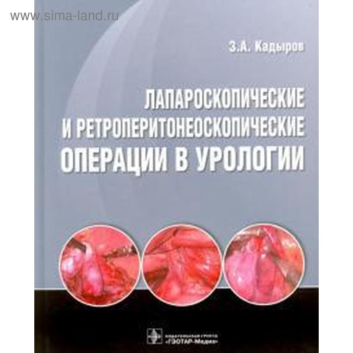 Лапароскопические и ретроперитонеоскопические операции в урологии гомеопатия в урологии