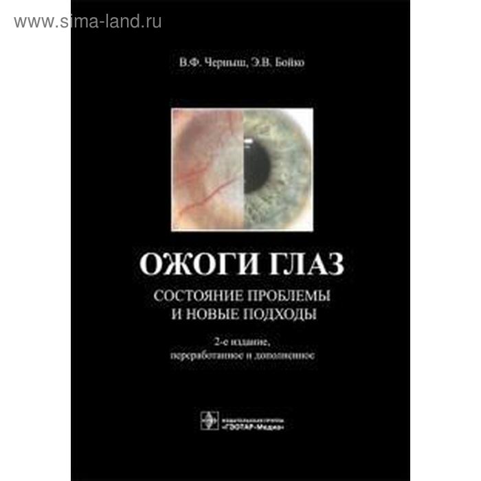 Ожоги глаз. Состояние проблемы и новые подходы состояние и проблемы продукционной гидробиологии