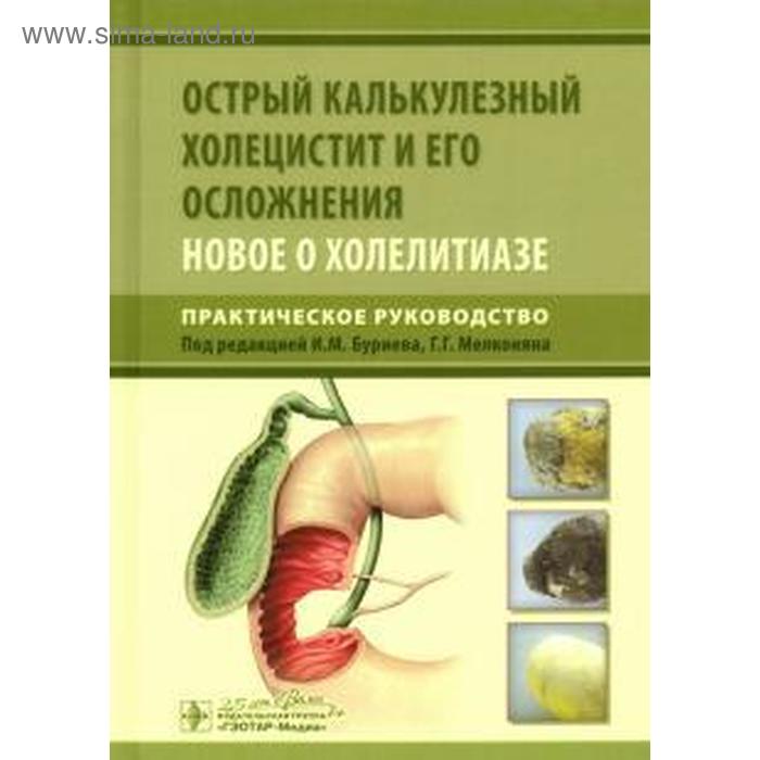 

Буриев, Мелконян, Веденина: Острый калькулезный холецистит и его осложнения. Новое о холелитиазе. Практическое руководство