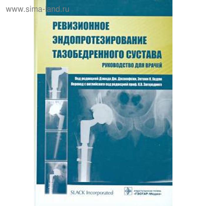 Ревизионное эндопротезирование тазобедренного сустава. Руководство для врачей шевцов георгий семёнович остеохондропатия тазобедренного сустава руководство для врачей