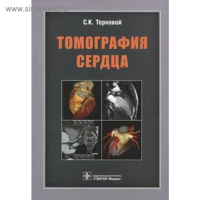 

Томография сердца. Терновой С.
