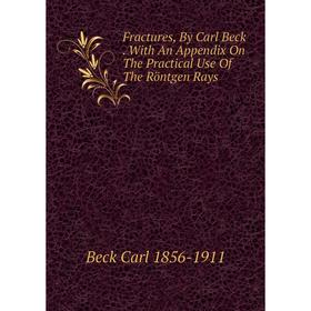 

Книга Fractures, By Carl Beck. With An Appendix On The Practical Use Of The Röntgen Rays