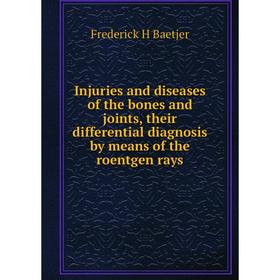 

Книга Injuries and diseases of the bones and joints, their differential diagnosis by means of the roentgen rays