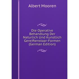 

Книга Die Operative Behandlung Der Naturlich Und Kunstlich Gereiftenstaar-Formen (German Edition)