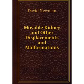 

Книга Movable Kidney and Other Displacements and Malformations