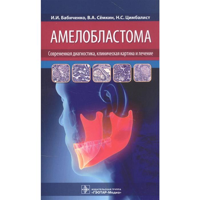 

Амелобластома: современная диагностика, клиническая картина и лечение. Бабиченко И. И.