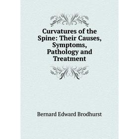 

Книга Curvatures of the Spine: Their Causes, Symptoms, Pathology and Treatment