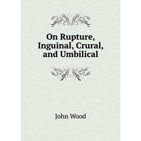 

Книга On Rupture, Inguinal, Crural, and Umbilical