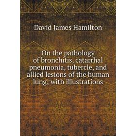 

Книга On the pathology of bronchitis, catarrhal pneumonia, tubercle, and allied lesions of the human lung; with illustrations