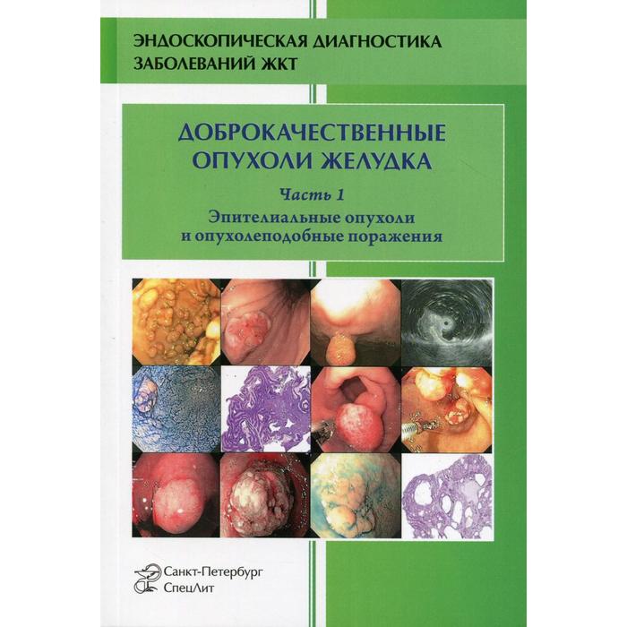 

Доброкачественные опухоли желудка и опухолеподобные поражения желудка. Часть 1. Учебно-методическое пособие