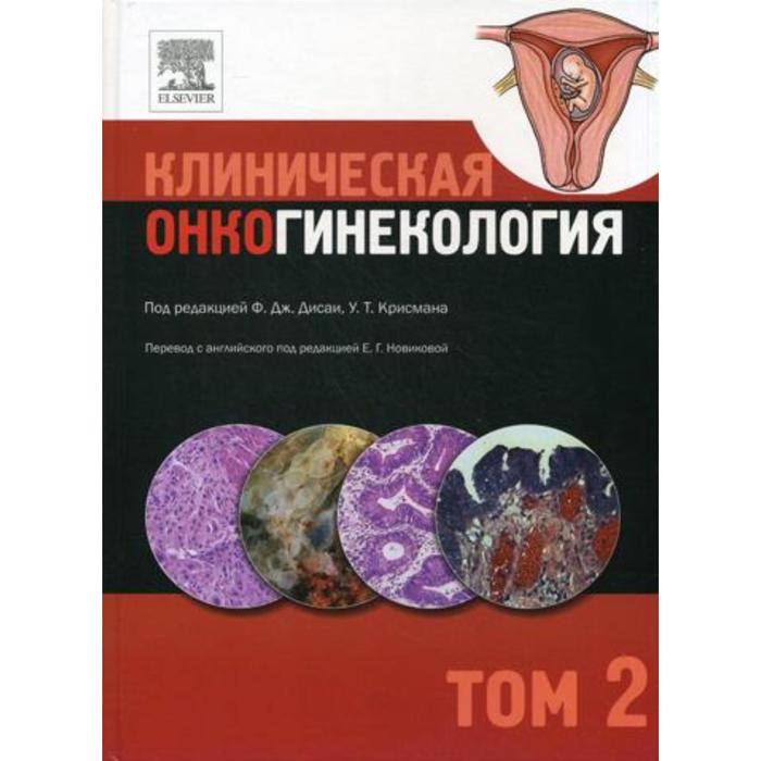 

Клиническая онкогинекология. В 3 томах. Том 2. Под ред. Ф.Дж. Дисаи, У.Т. Крисмана