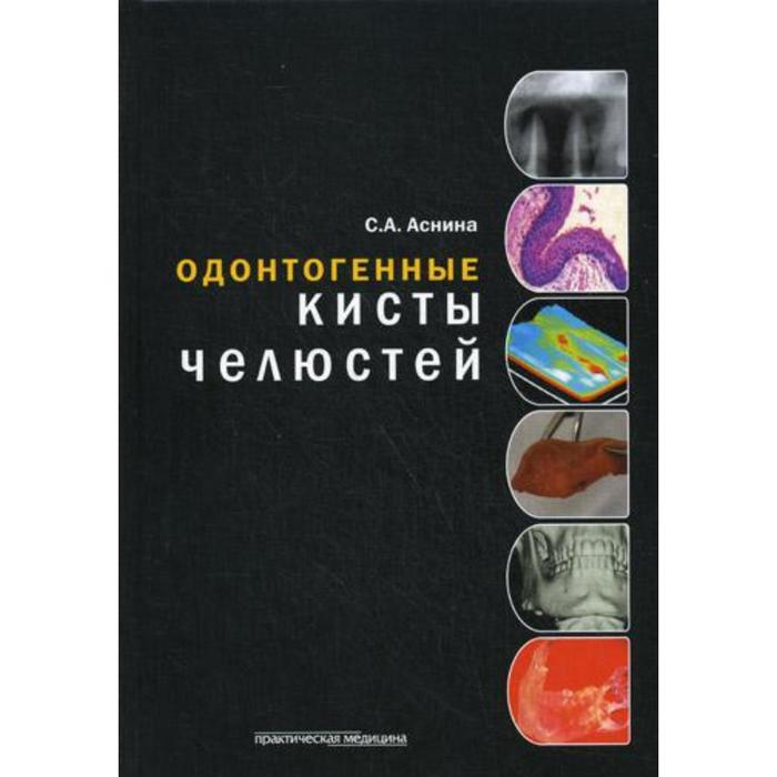 

Одонтогенные кисты челюстей. Аснина С. А., под. ред. Дробышева А. Ю.